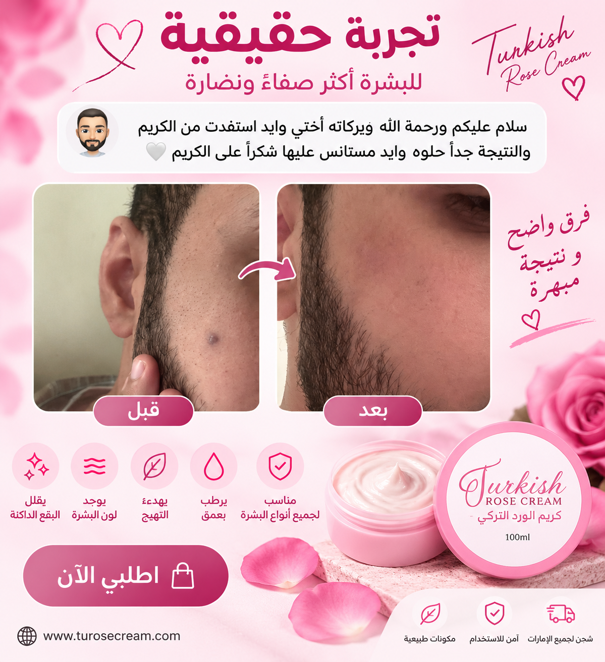 كريم الوردة التركية